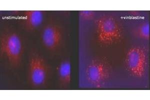 Immunofluorescence (IF) image for anti-Microtubule-Associated Protein 1 Light Chain 3 beta (MAP1LC3B) (N-Term) antibody (ABIN492614) (LC3B anticorps  (N-Term))
