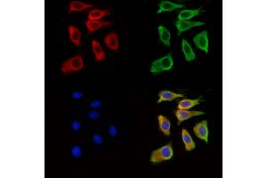 ABIN7094888 and ABIN7098941 staining Hela cells by IF/ICC.