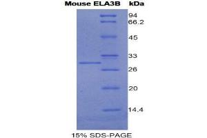 SDS-PAGE (SDS) image for Elastase 3B, Pancreatic (ELA3B) (AA 28-267) protein (His tag) (ABIN1981156) (Elastase 3B Protein (AA 28-267) (His tag))