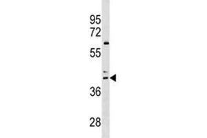 CCR4 antibody western blot analysis in HL-60 lysate