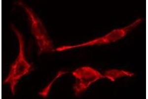 ABIN6275463 staining A549  cells by IF/ICC. (RAB2A anticorps  (Internal Region))