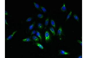 Immunofluorescent analysis of Hela cells using ABIN7169615 at dilution of 1:100 and Alexa Fluor 488-congugated AffiniPure Goat Anti-Rabbit IgG(H+L)