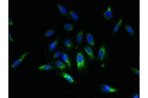 Immunofluorescent analysis of Hela cells using ABIN7169615 at dilution of 1:100 and Alexa Fluor 488-congugated AffiniPure Goat Anti-Rabbit IgG(H+L) (SPCS2 anticorps  (AA 7-86))