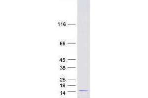 Validation with Western Blot