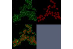 Confocal immunofluorescence image of HeLa cells using Catenin, gamma Mouse Monoclonal Antibody (15F11) Green (CF488) and Reddot is used to label the nuclei Red. (JUP anticorps)