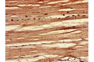 Immunohistochemistry of paraffin-embedded human skeletal muscle tissue using ABIN7152425 at dilution of 1:100