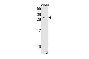 Western blot analysis of TIMP3 Antibody Pab pre-incubated without(lane 1) and with(lane 2) blocking peptide in mouse NIH-3T3 cell line lysate.