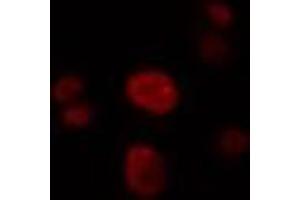 ABIN6274322 staining LOVO cells by IF/ICC.
