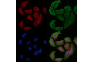 ABIN6261604 and ABIN6266802 staining Hela cells by IF/ICC. (EPS8-Like 2 anticorps  (N-Term))