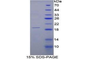 SDS-PAGE analysis of Rat RNASE3 Protein. (RNASE3 Protéine)