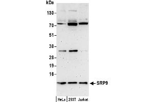 Western Blotting (WB) image for anti-Signal Recognition Particle 9kDa (SRP9) (AA 36-86) antibody (ABIN7451028)