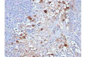 Image no. 3 for anti-Melanoma Cell Adhesion Molecule (MCAM) antibody (ABIN6153300) (MCAM anticorps)