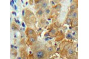 IHC-P analysis of Liver tissue, with DAB staining. (F12 anticorps  (AA 352-587))
