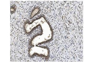IHC analysis of EIF2B1 using anti-EIF2B1 antibody (ABIN7602821).