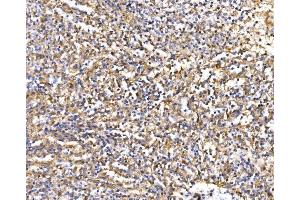 IHC analysis of Epac1/RAPGEF3 using anti-Epac1/RAPGEF3 antibody (ABIN7601858). (RAPGEF3 anticorps  (AA 49-881))