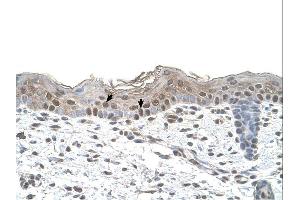 IHC Information: Human skin.