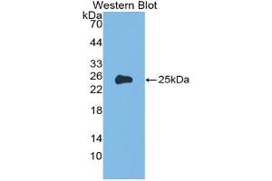 Detection of Recombinant a1AGP, Rat using Polyclonal Antibody to Alpha-1-Acid Glycoprotein (a1AGP) (ORM1 anticorps  (AA 19-201))