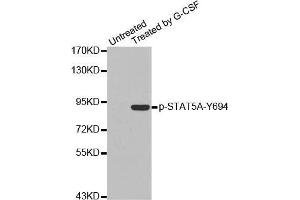 Western blot analysis of extracts from K562 cells using Phospho-STAT5A-Y694 antibody.