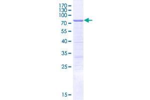 Image no. 1 for Cytokine-Dependent Hematopoietic Cell Linker (CLNK) (AA 1-428) protein (GST tag) (ABIN4369912)
