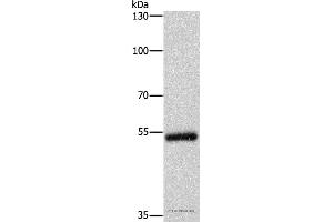 Western blot analysis of Human colon cancer tissue, using CYP2B6 Polyclonal Antibody at dilution of 1:400 (CYP2B6 anticorps)