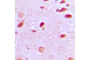 Immunohistochemical analysis of RAP1GAP staining in human brain formalin fixed paraffin embedded tissue section.