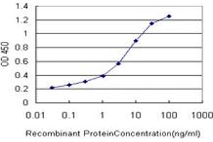 Detection limit for recombinant GST tagged ERN1 is approximately 0. (ERN1 anticorps  (AA 401-500))