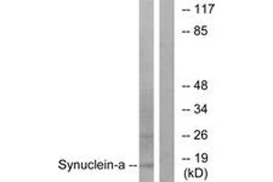 Western blot analysis of extracts from 293 cells, treated with Etoposide 25myM 60', using Synuclein-alpha (Ab-133) Antibody. (SNCA anticorps  (AA 91-140))
