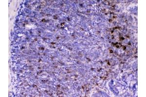 IHC testing of FFPE rat lymph tissue with CD14 antibody at 1ug/ml.