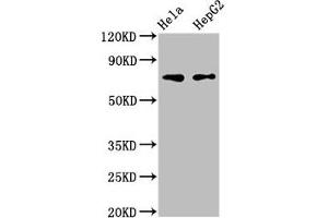 Western Blot Positive WB detected in: Hela whole cell lysate, HepG2 whole cell lysate All lanes: FRMD6 antibody at 3 μg/mL Secondary Goat polyclonal to rabbit IgG at 1/50000 dilution Predicted band size: 73, 71, 30 kDa Observed band size: 73 kDa (FRMD6 anticorps  (AA 413-622))
