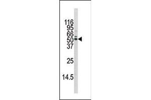 Image no. 1 for anti-V-Akt Murine Thymoma Viral Oncogene Homolog 1 (AKT1) (pSer129) antibody (ABIN358075)