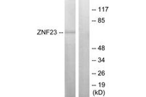 Western blot analysis of extracts from LOVO cells, using ZNF23 Antibody. (ZNF23 anticorps  (AA 151-200))