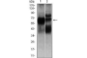 Western blot analysis using HEXA antibody against L1210 (1), and HL7702 (2) cell lysate. (Hexosaminidase A anticorps)