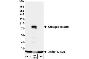 Western Blotting (WB) image for anti-Androgen Receptor (AR) (AA 1-50) antibody (ABIN7795784)