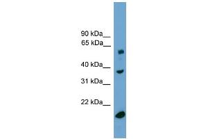 WB Suggested Anti-TBL1Y Antibody Titration:  0. (TBL1Y anticorps  (Middle Region))