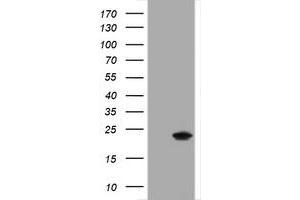 Western Blotting (WB) image for anti-Crystallin, alpha A (CRYAA) antibody (ABIN1498755) (CRYAA anticorps)