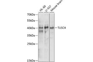 Western blot analysis of extracts of various cell lines, using NPRL2 antibody (ABIN6132809, ABIN6144787, ABIN6144788 and ABIN6221564) at 1:1000 dilution. (NPRL2 anticorps  (AA 1-220))