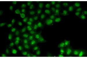 Immunofluorescence analysis of U2OS cells using C11orf30 Polyclonal Antibody (EMSY anticorps)