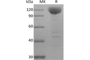 Western Blotting (WB) image for Sialic Acid Binding Ig-Like Lectin 10 (SIGLEC10) (Active) protein (Biotin) (ABIN7319878)