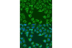 Immunofluorescence analysis of U2OS cells using  antibody (ABIN7265695) at dilution of 1:100.