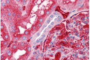 Human Kidney: Formalin-Fixed, Paraffin-Embedded (FFPE) (APOA2 anticorps  (AA 1-100))