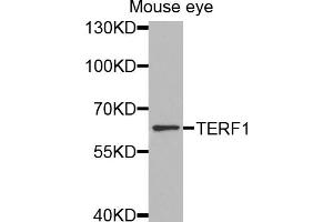 Western blot analysis of extracts of mouse eye, using TERF1 antibody (ABIN5970015) at 1/1000 dilution. (TRF1 anticorps)