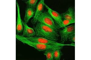IF analysis of SPRED2 using anti-SPRED2 antibody (ABIN7601643) and anti-Tubulin Alpha antibody (ABIN7600339). (SPRED2 anticorps  (AA 40-298))