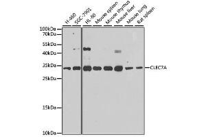Western blot analysis of extracts of various cell lines, using CLEC7A antibody.