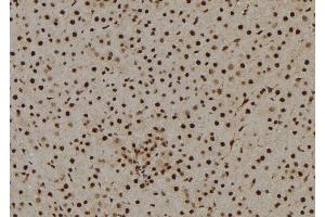 ABIN6269146 at 1/100 staining Rat liver tissue by IHC-P. (Cyclin B1 anticorps  (Internal Region))