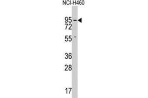 Western blot analysis of GUCY1A2 polyclonal antibody  in NCI-H460 cell lysate (35 ug/lane). (GUCY1A2 anticorps  (C-Term))