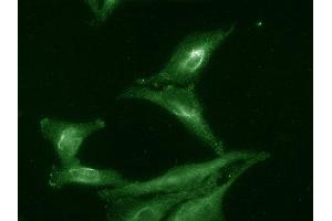 anti-Activator of HSP90 ATPase Activity 1 (AHSA1) antibody