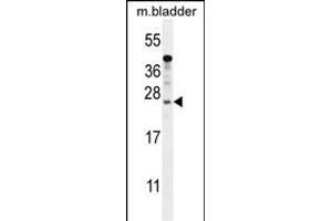 KI Antibody (N-term) (ABIN654385 and ABIN2844131) western blot analysis in mouse bladder tissue lysates (35 μg/lane). (SHISAL1/KIAA1644 anticorps  (N-Term))