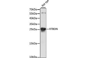 Western blot analysis of extracts of rat eye, using RTBDN antibody (ABIN7269926) at 1:1000 dilution. (Retbindin anticorps  (AA 63-261))