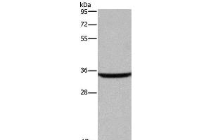 Western Blot analysis of Human fetal brain tissue using DKK3 Polyclonal Antibody at dilution of 1:200 (DKK3 anticorps)
