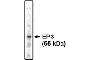 Western Blotting (WB) image for anti-Prostaglandin E Receptor 3 (Subtype EP3) (PTGER3) antibody (ABIN264448) (PTGER3 anticorps)